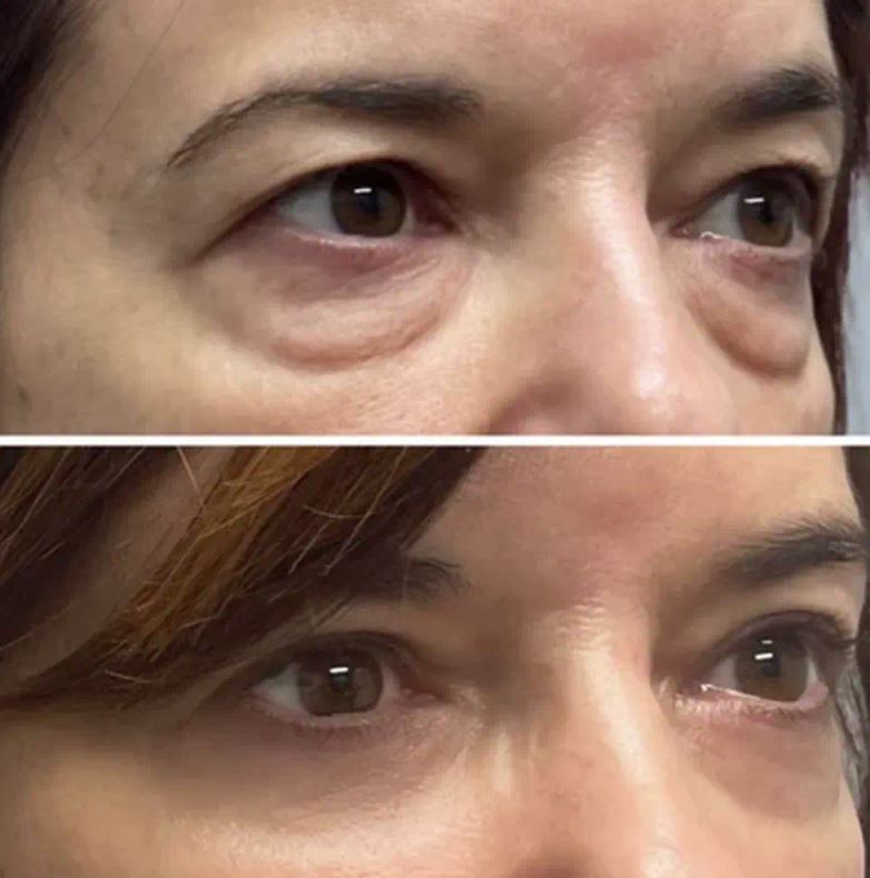 Capture432.JPG__PID:3b997976-e2c1-484a-a8a0-b2a129b28ae5